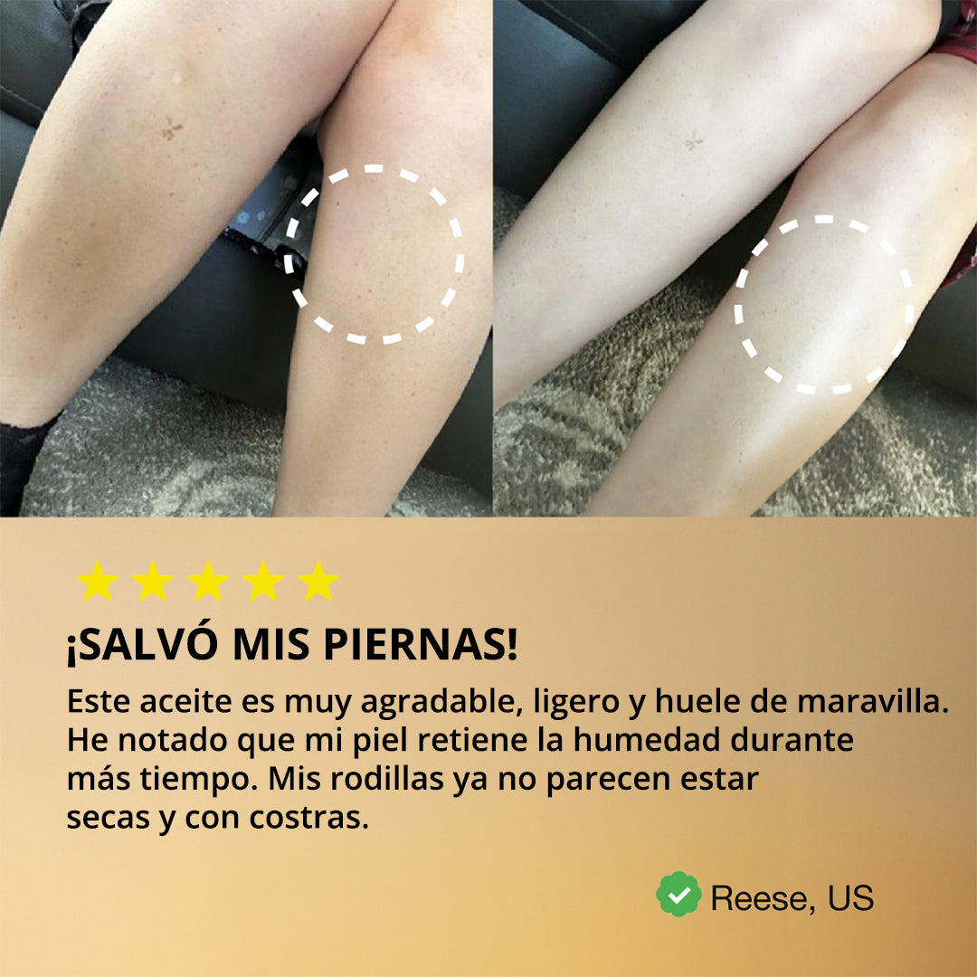 Balaayah Black Gram Booster - Mejor Aceite Corporal para Piel Seca - Aceite de Masaje Natural para el Cuidado de la Piel - Hidratante Corporal Mejor que la Loción Corporal